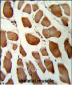 GSTO1 Antibody (Center)